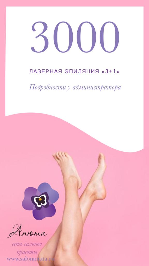 Лазерная эпиляция «3+1»
